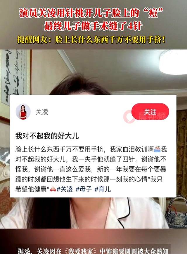痘”导致儿子做手术脸上缝了4针MG不朽情缘演员关凌用针挑开“